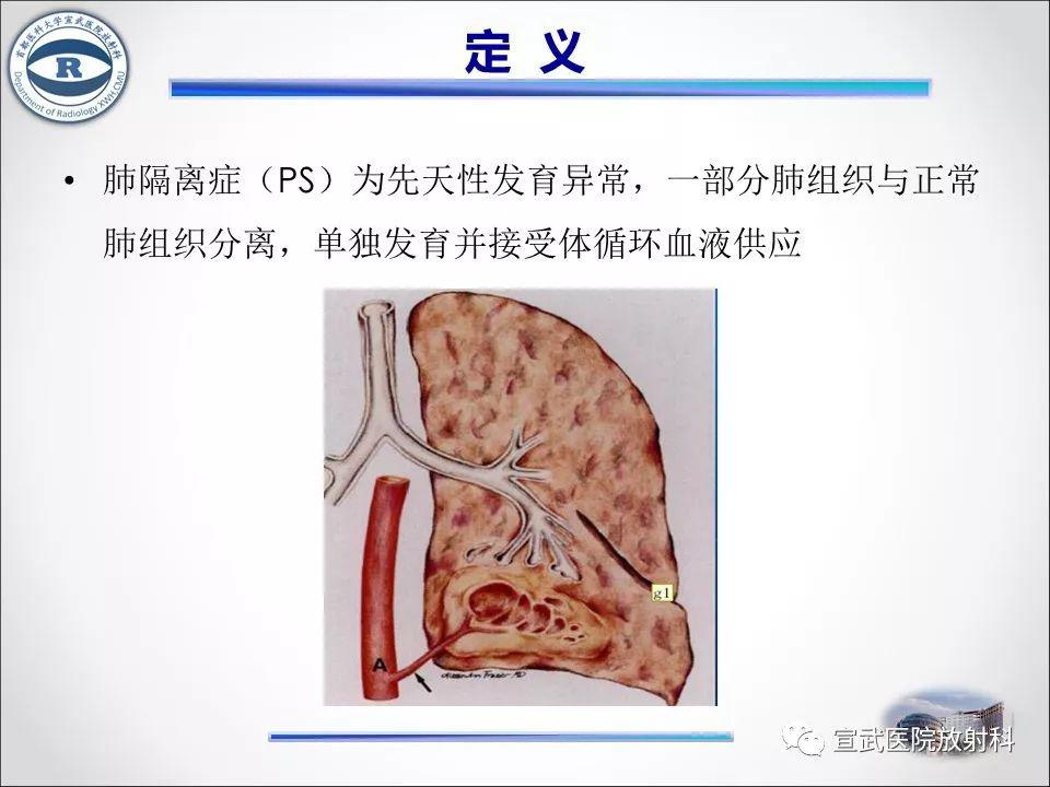 肺隔离症的影像表现