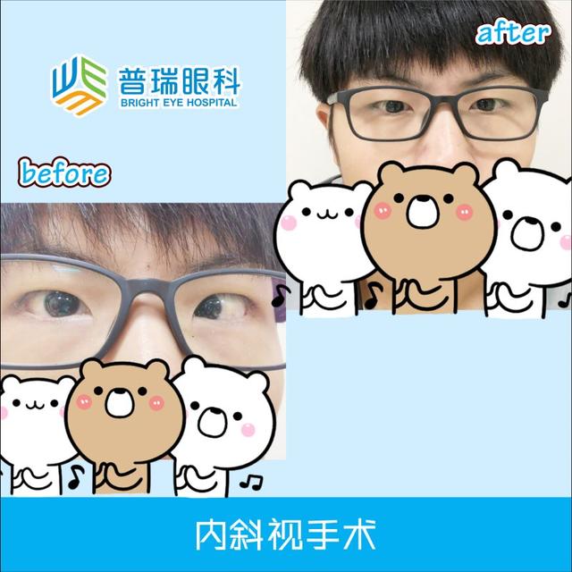『孩子』竟然和眼睛有关！孩子走路老摔跤