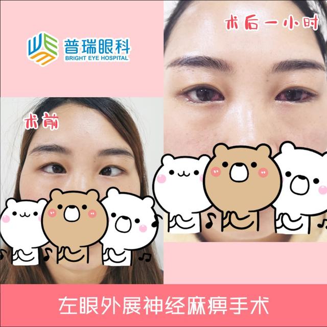 『孩子』竟然和眼睛有关！孩子走路老摔跤