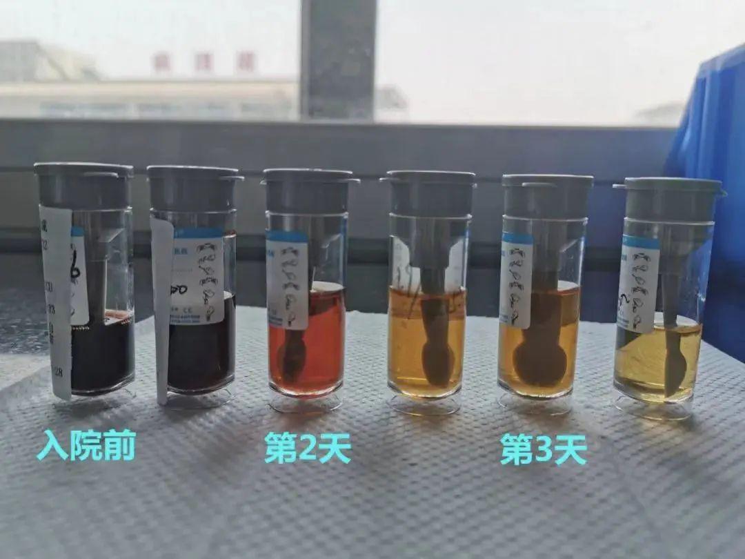【男孩】尤其男孩要当心！眼下正当季突发！孩子吃这种蔬菜住进ICU