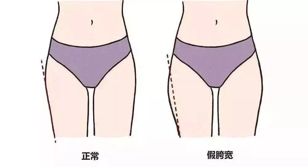 如何快速瘦屁股和大腿根 8e2794ffd1ff4189be107c686861bbdc.jpeg