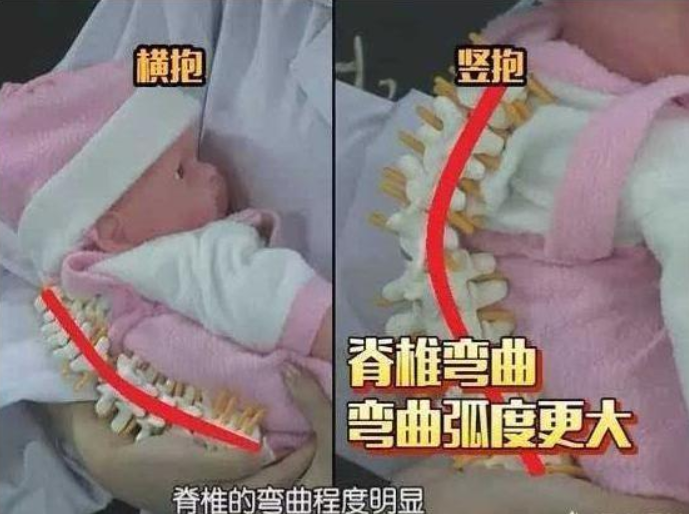[宝宝]脊柱“弯了”，医生：父母可别做“糊涂”事宝宝刚出生三个月