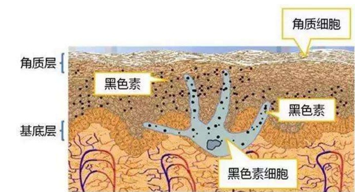 宝宝额头上有白斑怎么办