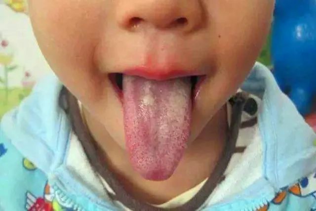 「孩子」遇上时不慌乱孩子积食的信号你知道几个？家长早知道好心里有底