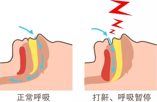 小心"睡过去"!