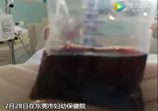 一口家常菜让宝宝吃进急救室！有些菜真的不能让孩子随便吃…