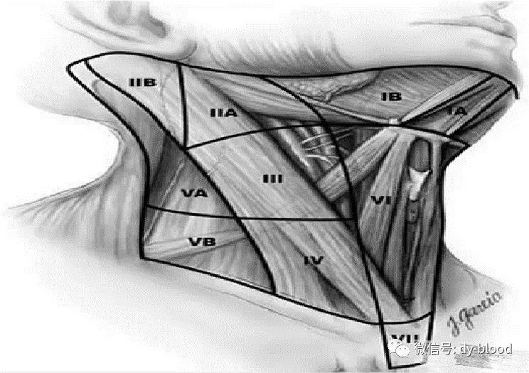 颈部淋巴结分区