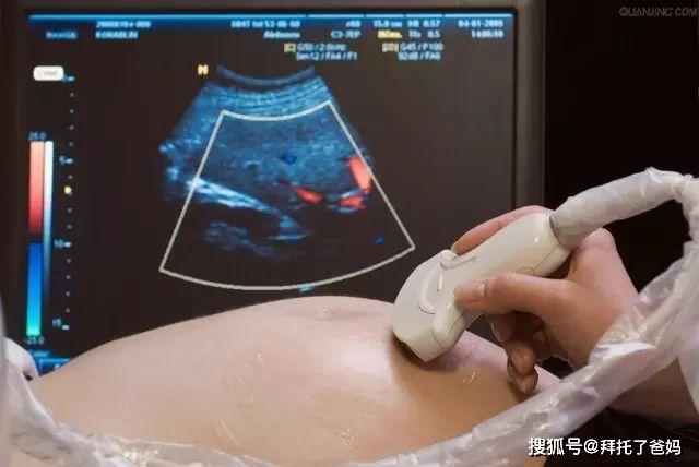 孕期B超中最重要的“大畸形筛查”，孕中期一定不能错过的产检