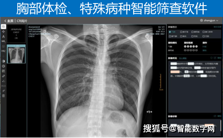 减缓人口压力_减缓心理压力宣导