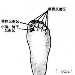 老年痴呆很可怕预防原来这么简单可惜99的人不知道附视频