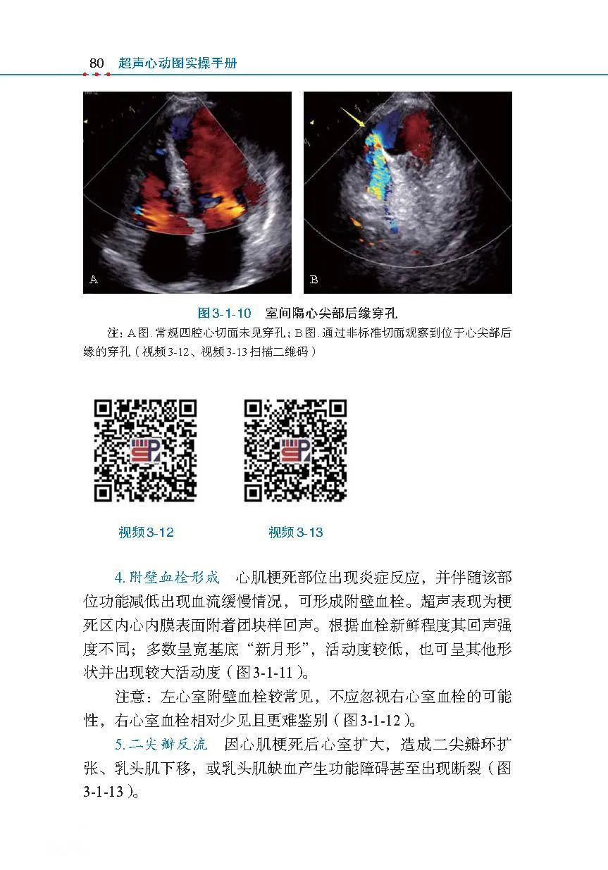 《超声心动图实操手册》:99个超声心动图影像视频,带你看图识病