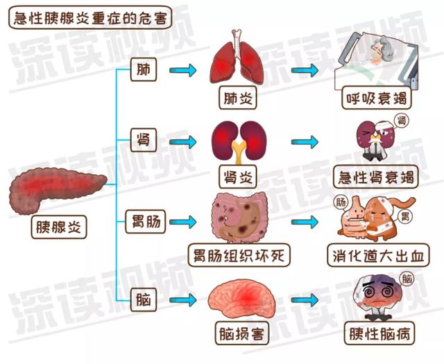 原创一宝妈坐月子大吃大喝,竟吃出急性胰腺炎!这病竟能半天要人命?