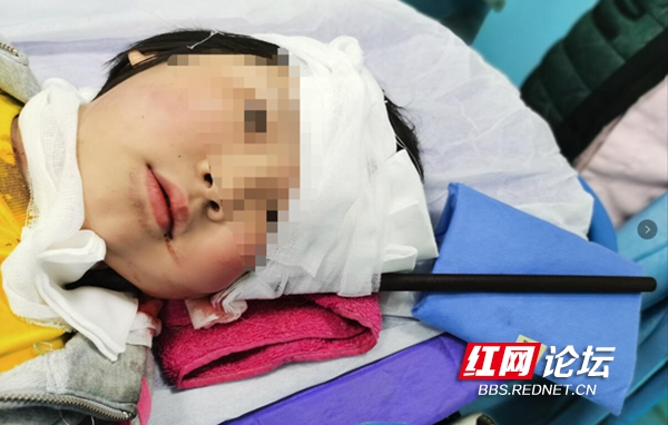 [女童]家长看好“熊”孩子郴州女童玩耍摔成贯穿伤 网友：超长寒假