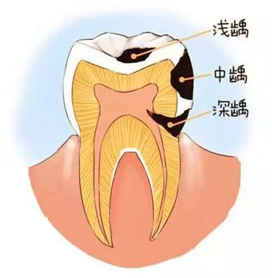 长治牙怎么办