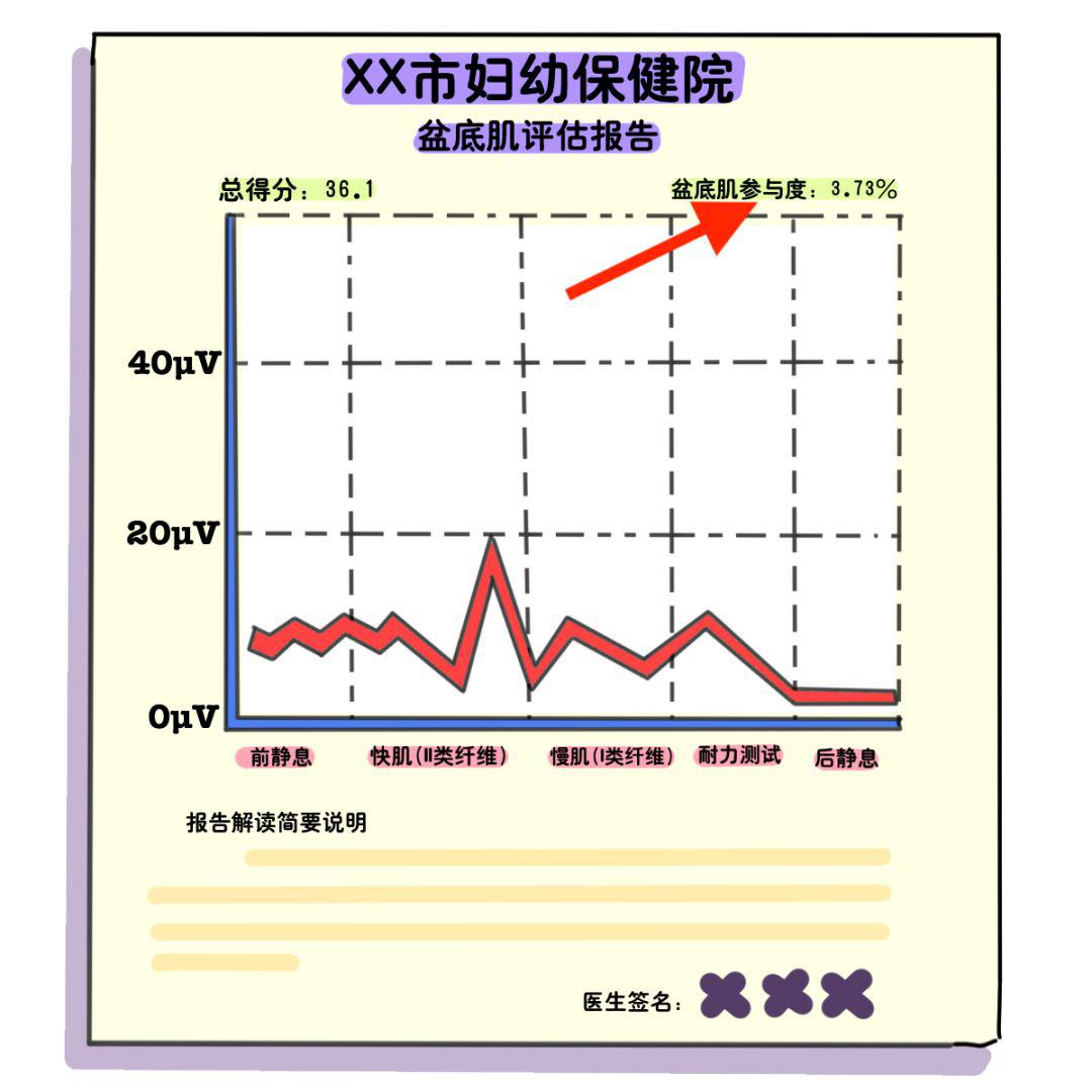 不注意这些,凯格尔运动等于白练