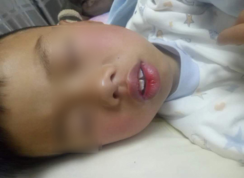 孩子:妈妈带娃去医院检查,医生一席话让妈妈自责不已儿子越长越像“猩猩”