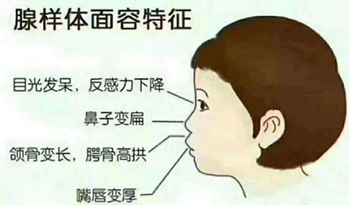 孩子:妈妈带娃去医院检查,医生一席话让妈妈自责不已儿子越长越像“猩猩”