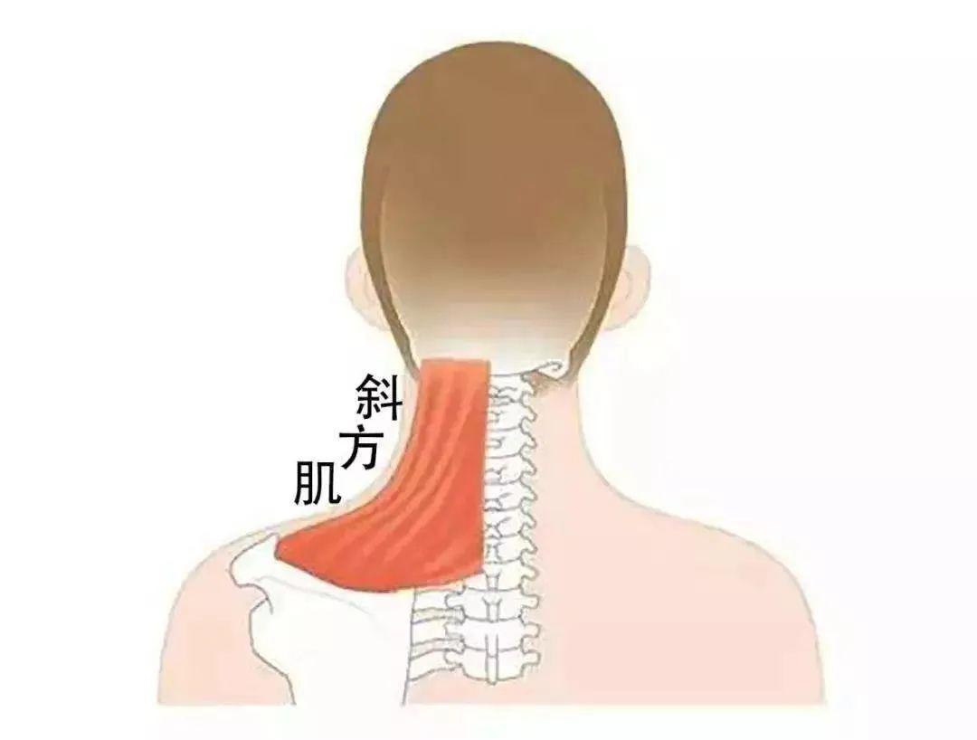 斜方肌就是长在脖子和肩膀连接位置的这块肌肉,是肩颈部浅层肌肉,呈