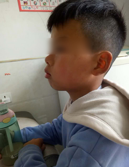 孩子:妈妈带娃去医院检查,医生一席话让妈妈自责不已儿子越长越像“猩猩”