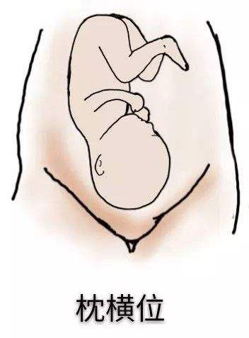 怎么看胎方位