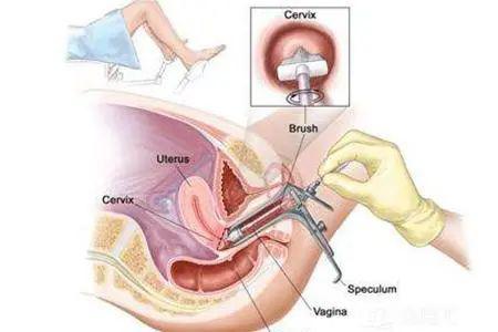 人流手术虽然不是大手术……