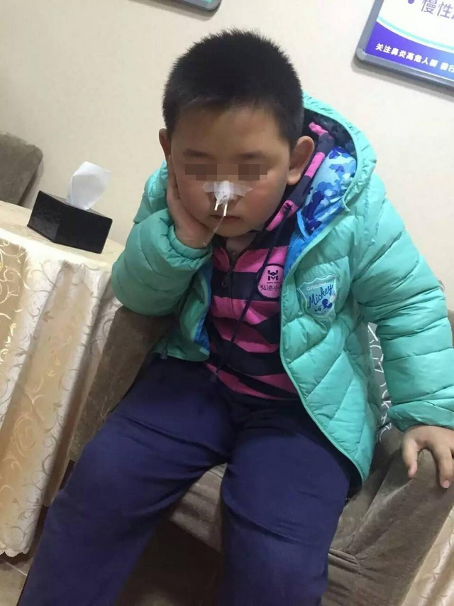 #孩子#当心宝宝患上过敏性鼻炎，很多爸妈们却误认为是感冒春季万花开