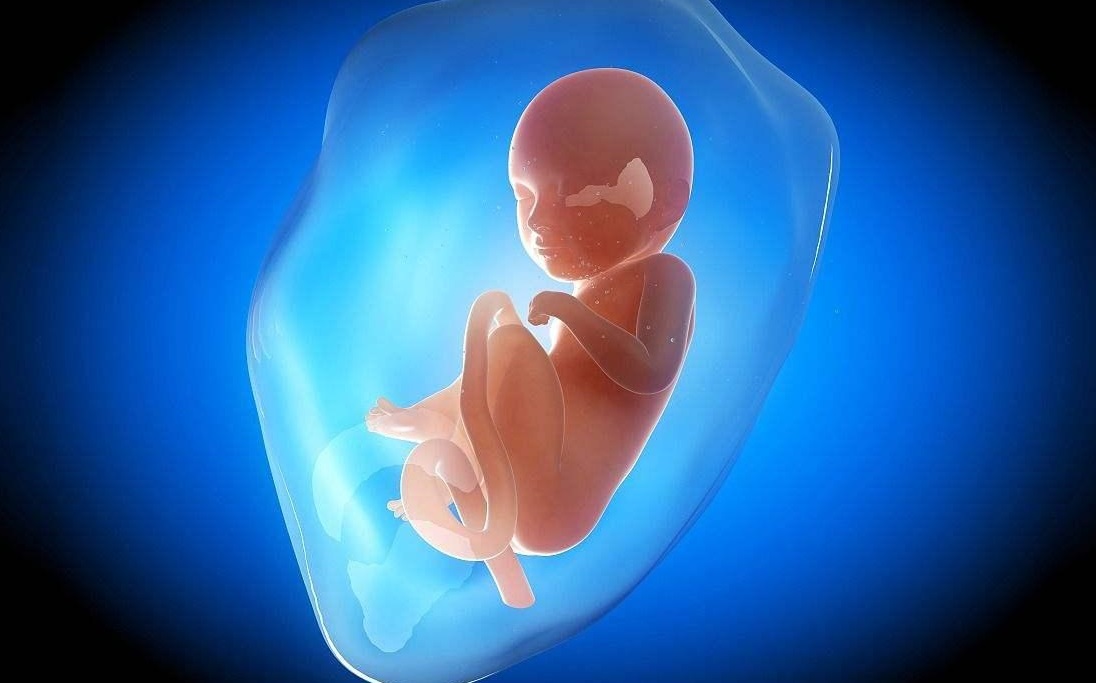 6个月脐带扭转导致胎停，是什么原因造成？以后怀孕要怎么注意？