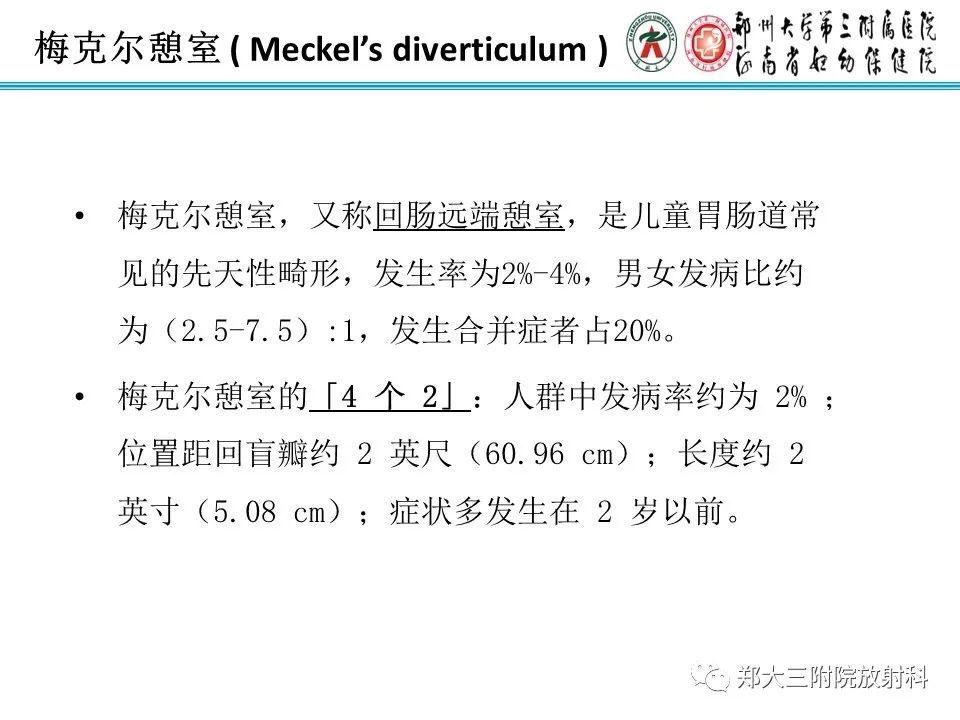 每日一例1052梅克尔憩室影像诊断