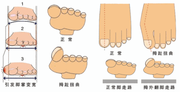 都是