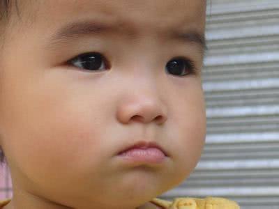 『白斑』是火上来了，别傻傻去补水，家长别不听孩子皮肤干燥“脱皮”