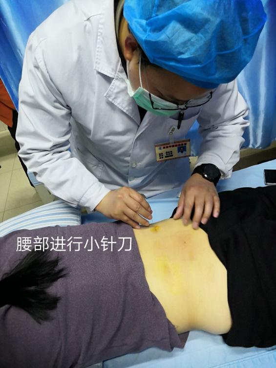疼痛的克星—小针刀