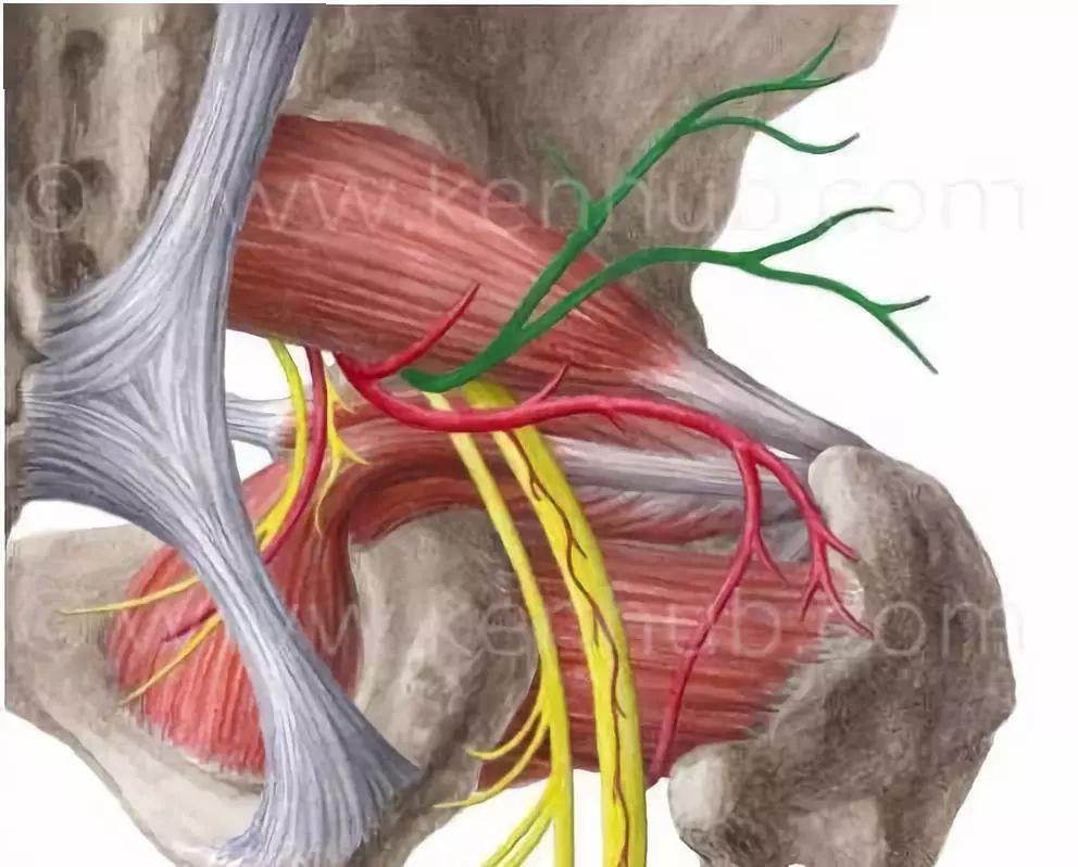 上/下孖(mā)肌,股方肌,闭孔内肌刺激压迫坐骨神经.