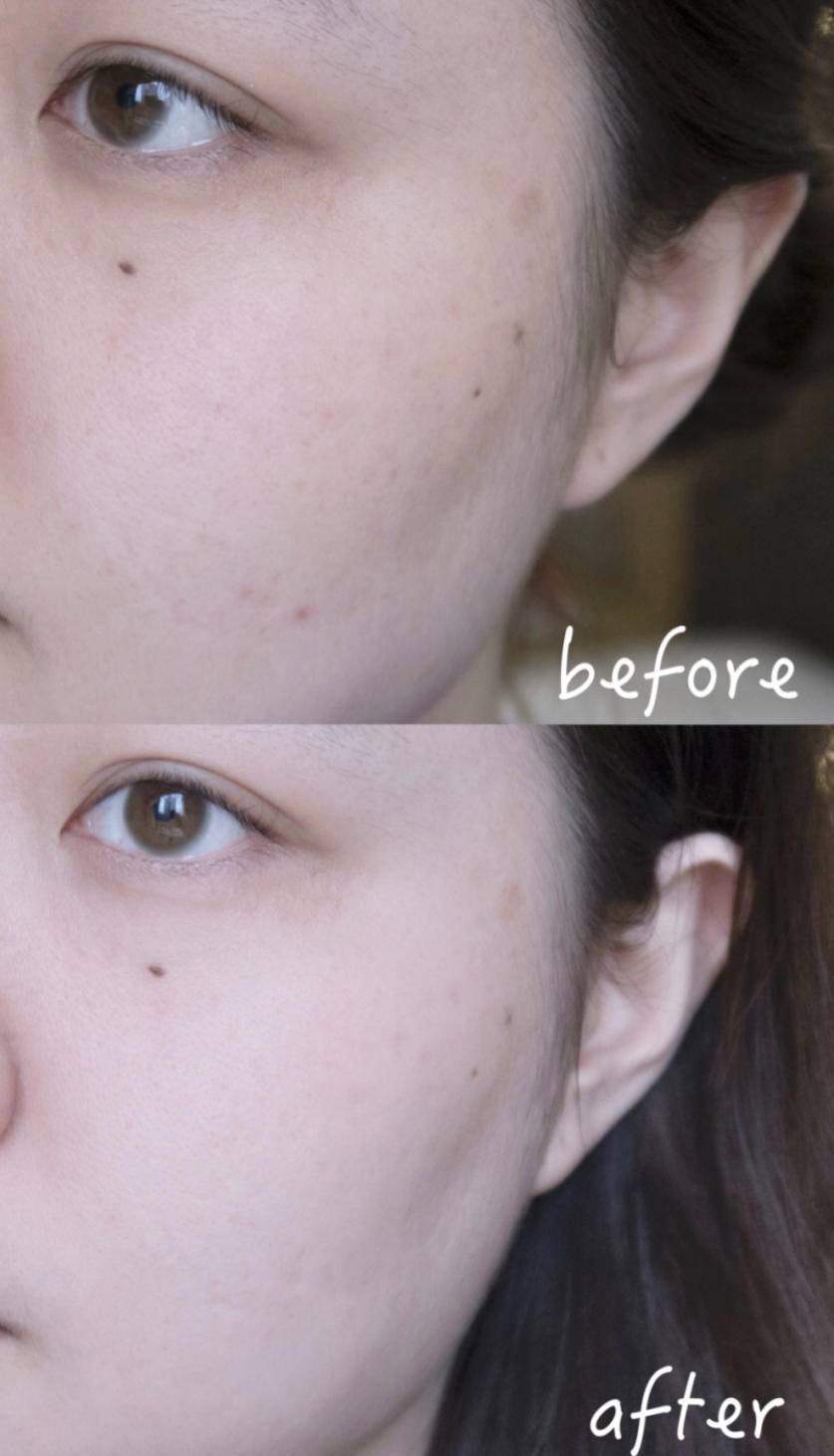 怎么才能不长痘痘祛除痘印 37ee3cc90cd84738bb0c65a7caec3ec2.jpeg