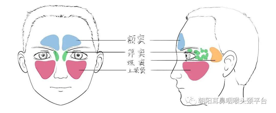 我们又把上颌窦,额窦及筛窦靠前的部分称为前组鼻窦,筛窦靠后部分及蝶