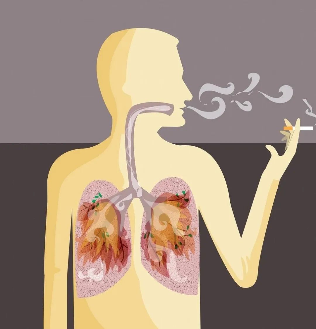 长期吸烟的人,若身体没有4种表现,恭喜你,说明肺部还算健康