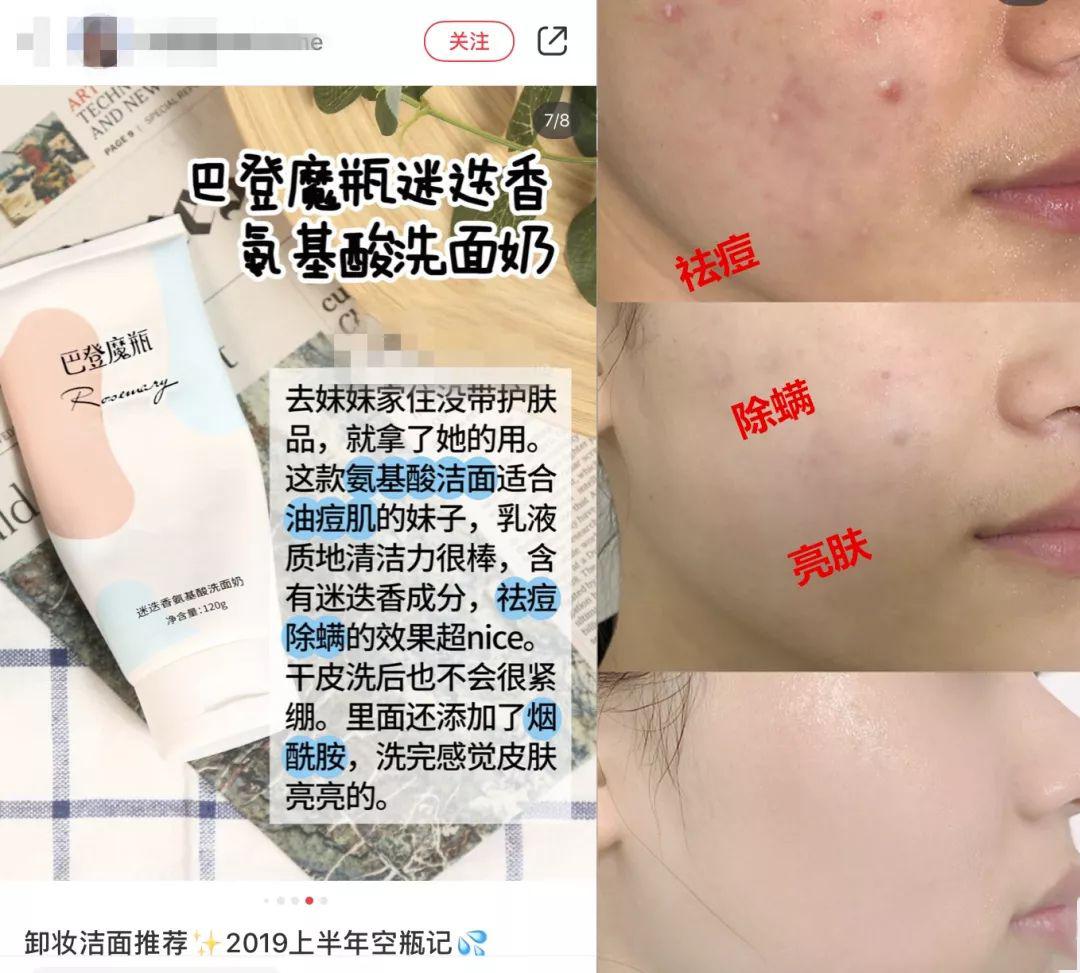 拒绝"螨虫脸"!5秒揉一揉,螨虫全出来了,痘痘黑头全没了!