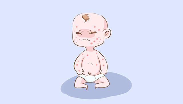 『妈妈』妈妈日常多防范，他少受罪！宝宝皮肤易出这4种问题
