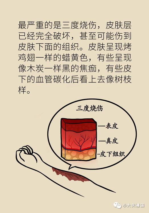 怎么样才能减少留疤的概率 6f96d31da7034f009eb1b4c5df672883.jpeg