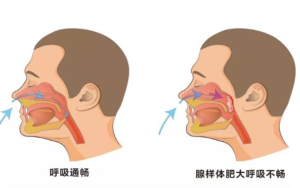 影响■四种危害找上门！再不纠正就晚了！宝宝睡觉有这个小习惯