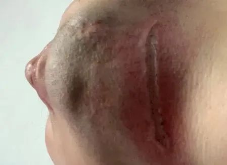 夫妻■夫妻一个动作双双被截肢惨痛!为孩子捡风筝