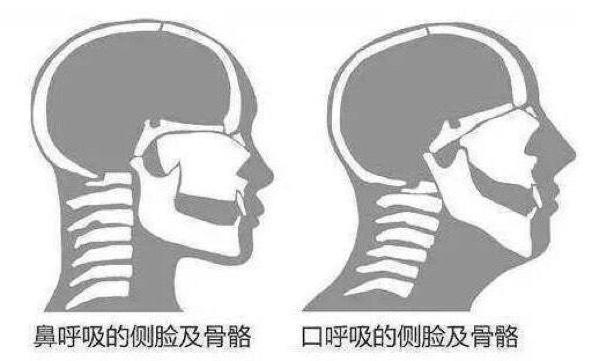 影响■四种危害找上门！再不纠正就晚了！宝宝睡觉有这个小习惯