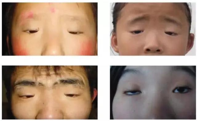 [网友]网友们纷纷调侃，宝妈是不是葡萄干吃多了小眼睛的宝宝火了