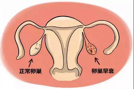 暖巢早衰怎么办