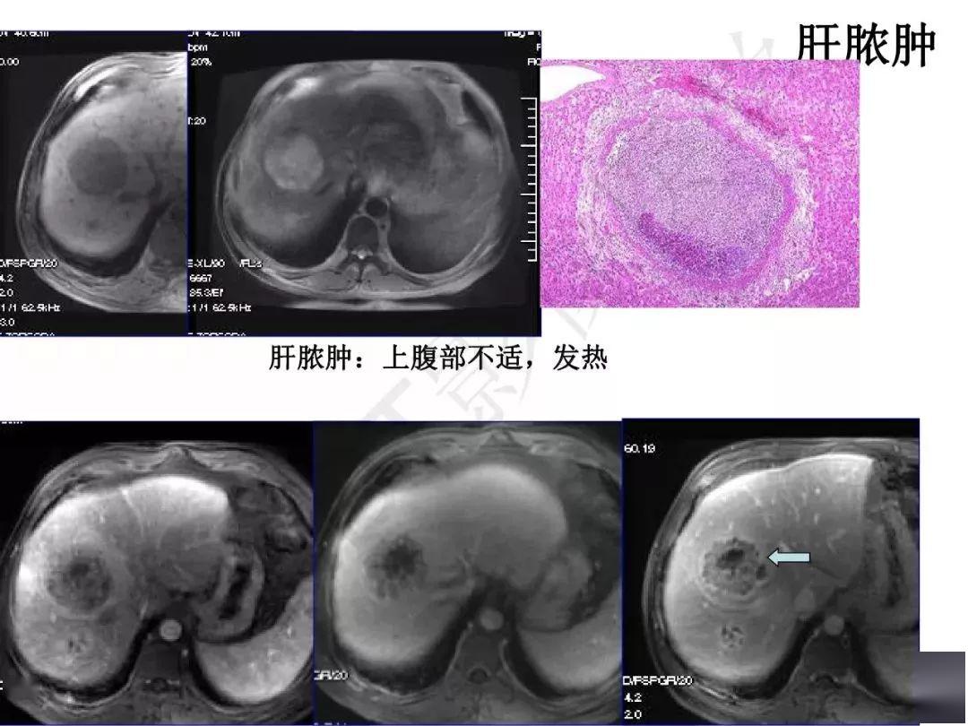肝脏gdp值_肝脏位置(3)