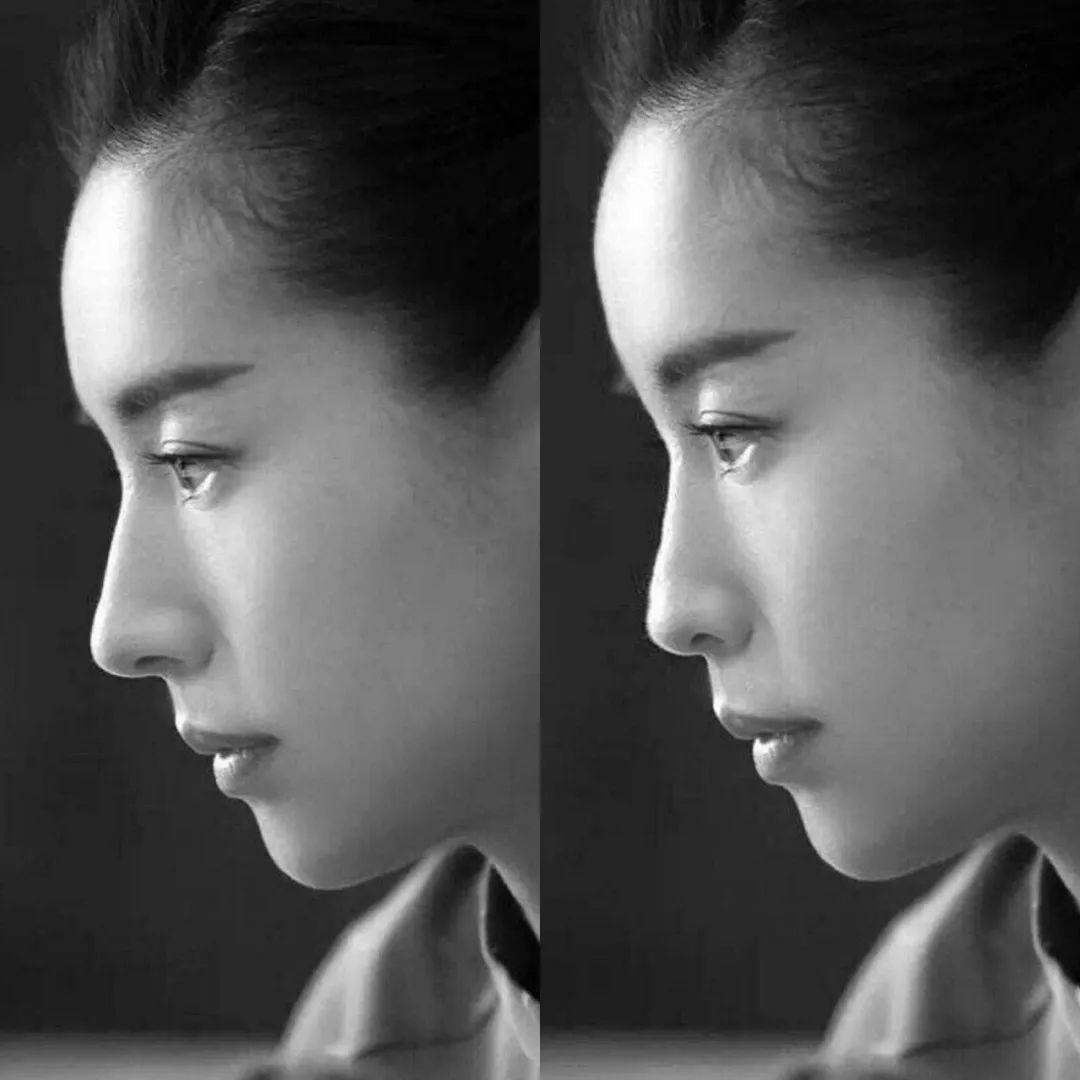 怎么才算高鼻梁侧脸 11d2302934e3406789cfce49c60e0d88.jpeg