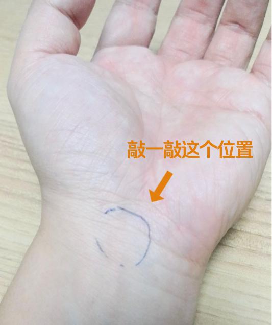 怎么治疗手麻最快最有效 3a8449b1aba24138b8dbc0458907a23c.jpeg