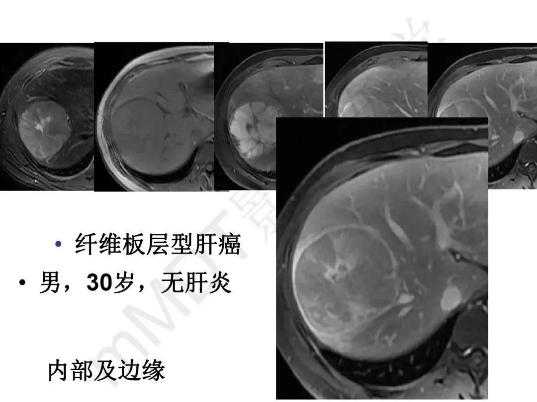 肝脏gdp值_肝脏位置(3)