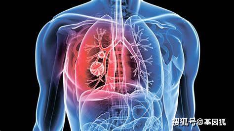 什么是基因突变有什么特征 9bed1cb437f24cdf8dc8a9e492a4bce7.jpeg