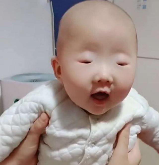 『眼睛』孙红雷都甘拜下风，网友：难道芝麻吃多了“眼睛最小宝宝”火了