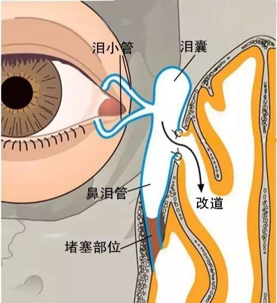 「泪道」宝宝总是无故流泪怎么办？宝妈们看过来！